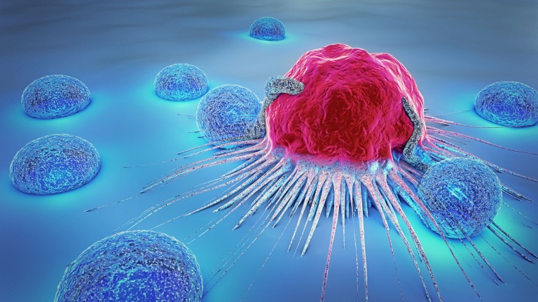 IOR researchers develop a novel method to track precisely prostate cancer progression